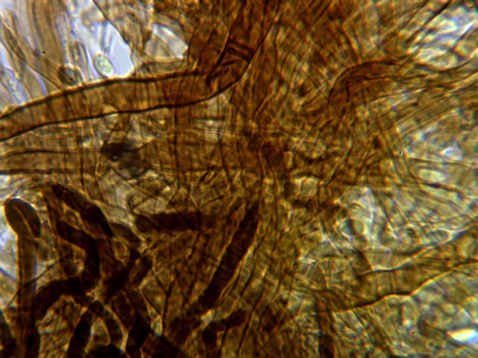 Microscopía de Phaeolus schweinitzii - 14 - Hifas contexto en KOH
